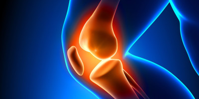 Kolagen – jaké má účinky na klouby? Kolagen – jaké má účinky na klouby?