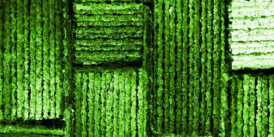 Prečo súvisí silná imunita so zdravým trávením Prečo súvisí silná imunita so zdravým trávením